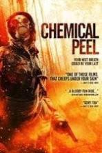 Chemical Peel ( 2014 )