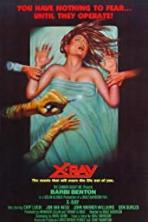 X-Ray (1981)